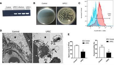 Prokineticin 2 via Calcium-Sensing Receptor Activated NLRP3 Inflammasome Pathway in the Testicular Macrophages of Uropathogenic Escherichia coli-Induced Orchitis